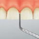 Restorative(For Preparation of crown cores)/S72D -AIR SCALER